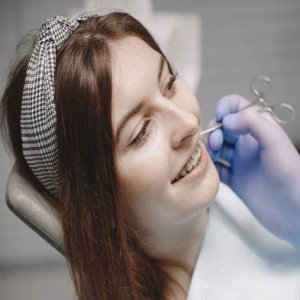 How Dental Braces in Edison Can Transform Your Teeth